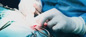 Diaz Newsletter Hernia - Have You Ever Experienced a Hernia?