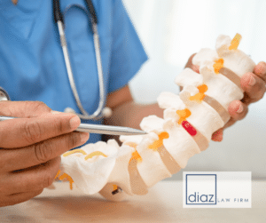 There are approximately 17,810 new spinal cord injuries each year in the U.S., according to the National Spinal Cord Injury Statistical Center (NSCISC).